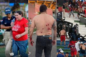 Rubber Bullets and Tear Gas Disrupt Olimpia vs Cerro Porteño Derby