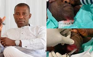 Businessman Kenpong Hospitalised After Serious Fall at Home