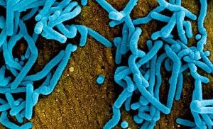 Ebola Outbreak Spreads in DRC and Uganda: What Health Authorities Know So Far