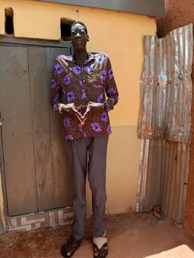 Ibrahim Mahama Offers to Pay Medical Bills of Ghana's Tallest Man Battling Gigantism