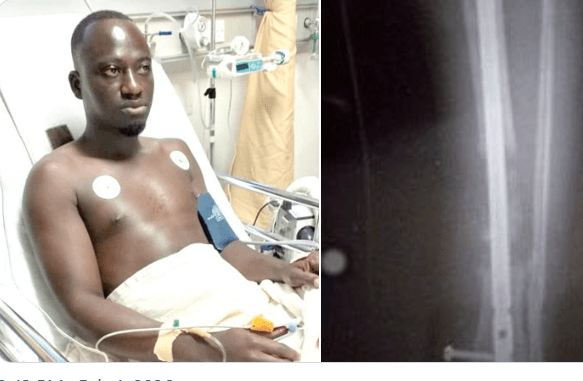 Veteran Journalist Shot During 2020 Elections Continues to Battle Life-Altering Injuries